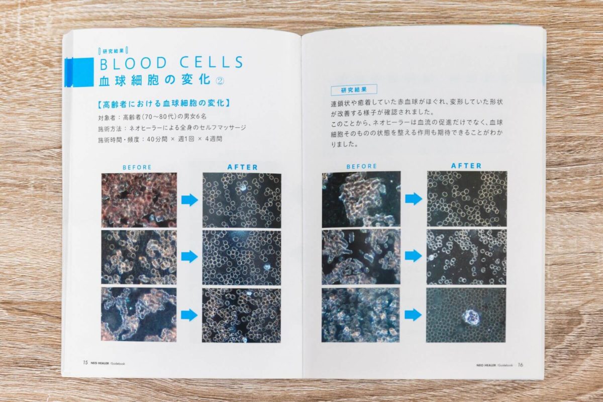 血球細胞 2 血球細胞