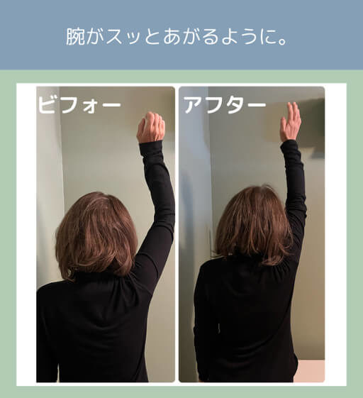 うでのビフォーアフター (1) うでのビフォーアフター