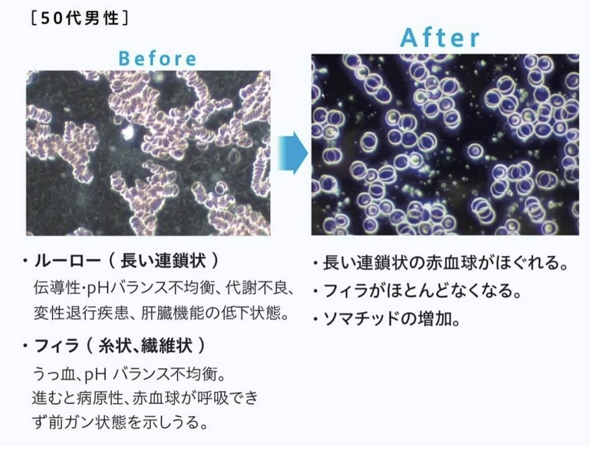 ネオヒーラー50代男性ビフォーアフター ネオヒーラー50代男性ビフォーアフター